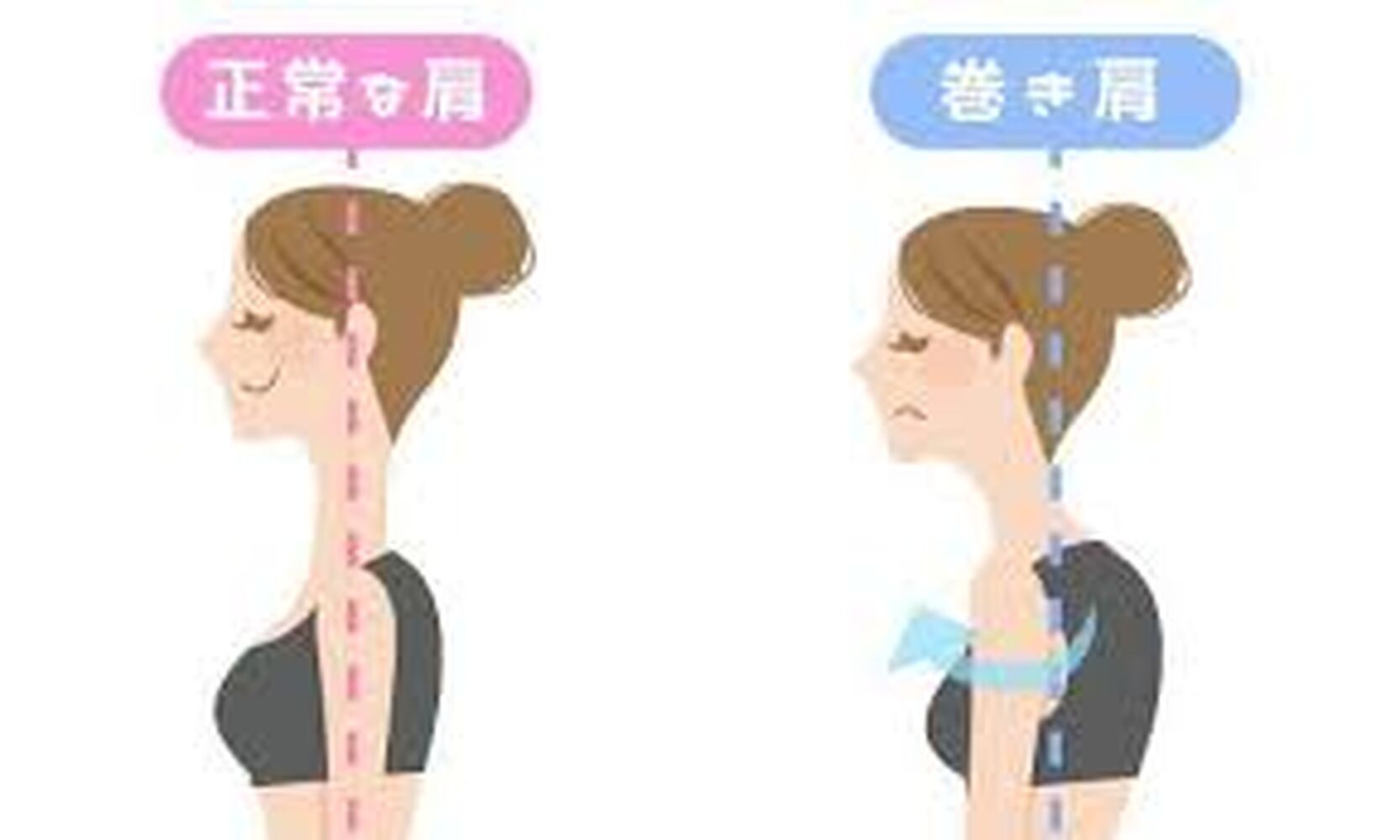 【巻き肩を改善するためにはどこを整えたらよいの！？】