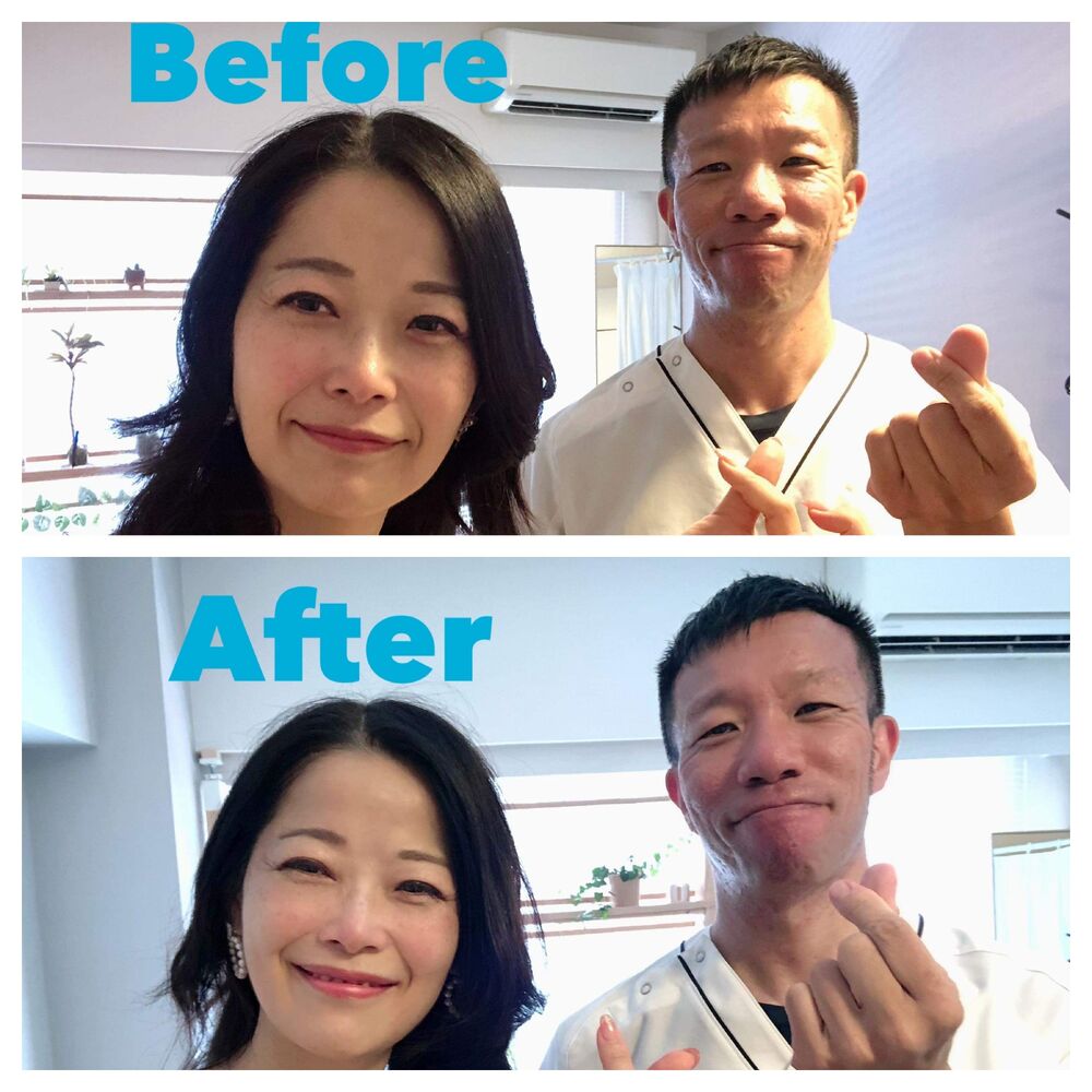 千代田区　半蔵門にある整体 　肩こり、腕の疲れ解消で小顔効果⁉